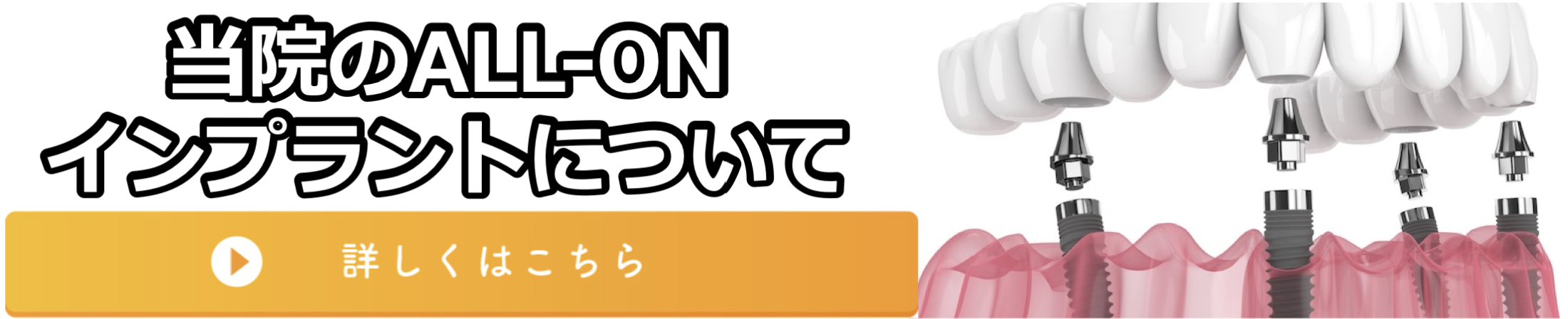 allonbanner01.png