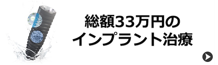 インプラントのご案内